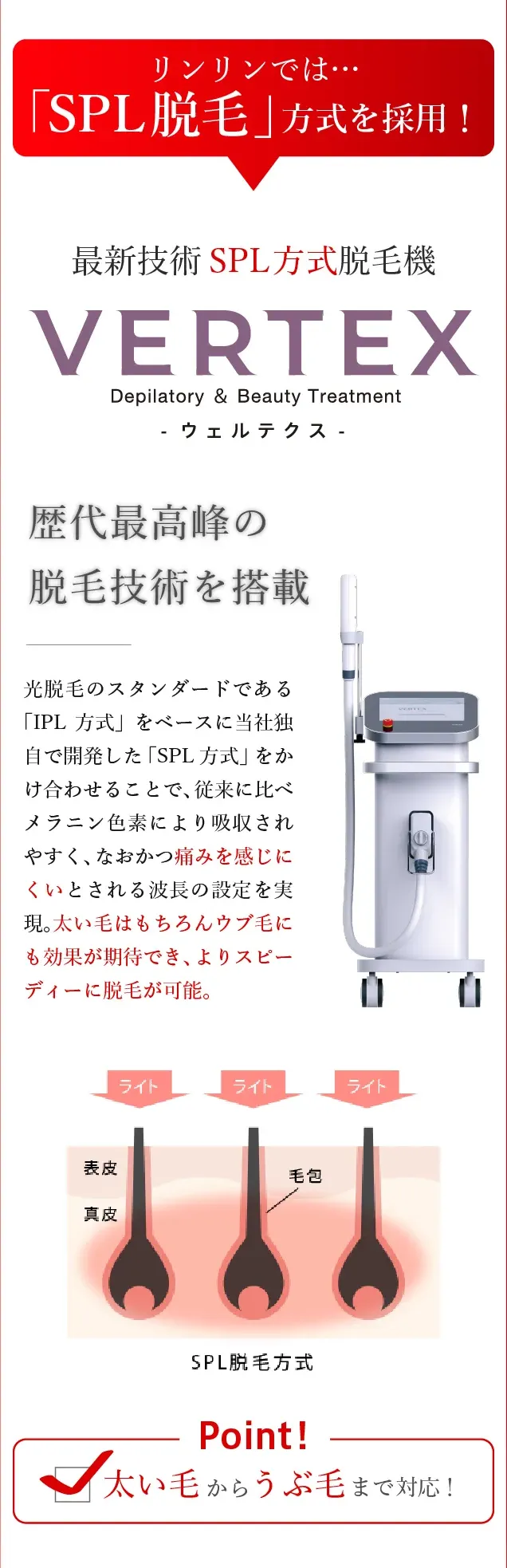 最新技術SPL方式脱毛機VERTEX。
