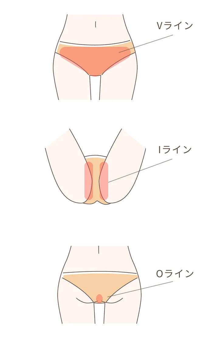 Vライン,Iライン,Oライン